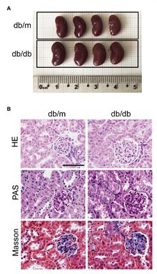 GADD45B Promotes Glucose-Induced Renal Tubular Epithelial-Mesenchymal Transition and Apoptosis via the p38 MAPK and JNK Signaling Pathways